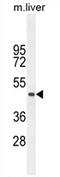 Transmembrane Protein 229A antibody, AP54194PU-N, Origene, Western Blot image 