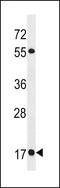 RAB19, Member RAS Oncogene Family antibody, LS-C158781, Lifespan Biosciences, Western Blot image 