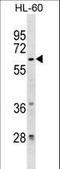Zinc Finger Protein 317 antibody, LS-C157436, Lifespan Biosciences, Western Blot image 