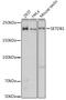 SET Domain Bifurcated Histone Lysine Methyltransferase 1 antibody, GTX33492, GeneTex, Western Blot image 