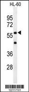 Interleukin 2 Receptor Subunit Gamma antibody, 63-952, ProSci, Western Blot image 