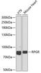 X-linked retinitis pigmentosa GTPase regulator antibody, GTX32845, GeneTex, Western Blot image 