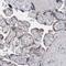 Perilipin 1 antibody, NBP1-87264, Novus Biologicals, Immunohistochemistry paraffin image 