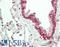 Melanoma-associated antigen 9 antibody, LS-B14177, Lifespan Biosciences, Immunohistochemistry paraffin image 