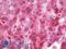 Mitochondrial Trans-2-Enoyl-CoA Reductase antibody, LS-B10065, Lifespan Biosciences, Immunohistochemistry frozen image 