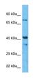 Vacuole Membrane Protein 1 antibody, orb330604, Biorbyt, Western Blot image 