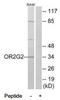 Olfactory Receptor Family 2 Subfamily G Member 2 antibody, TA326149, Origene, Western Blot image 