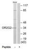 Olfactory Receptor Family 2 Subfamily G Member 2 antibody, TA326149, Origene, Western Blot image 