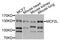 Guanine nucleotide exchange factor DBS antibody, STJ112007, St John