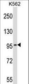 Phosphodiesterase 6A antibody, LS-C158560, Lifespan Biosciences, Western Blot image 