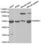 Arrestin Beta 1 antibody, LS-C331197, Lifespan Biosciences, Western Blot image 