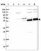 Tripartite Motif Containing 7 antibody, NBP1-89751, Novus Biologicals, Western Blot image 