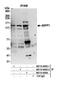 Protein Phosphatase 1 Regulatory Subunit 13B antibody, NB110-40683, Novus Biologicals, Western Blot image 