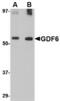 Growth Differentiation Factor 6 antibody, TA306608, Origene, Western Blot image 