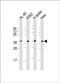 Serine Protease 21 antibody, PA5-49493, Invitrogen Antibodies, Western Blot image 