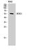 Activin A Receptor Like Type 1 antibody, STJ91563, St John