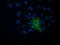 Vasodilator Stimulated Phosphoprotein antibody, LS-C172705, Lifespan Biosciences, Immunofluorescence image 