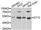 ST13 Hsp70 Interacting Protein antibody, A8454, ABclonal Technology, Western Blot image 