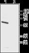 Potassium Voltage-Gated Channel Subfamily A Member 5 antibody, GTX16716, GeneTex, Western Blot image 