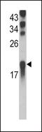 Ubiquitin Conjugating Enzyme E2 L3 antibody, PA5-11966, Invitrogen Antibodies, Western Blot image 