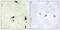 Chromatin Accessibility Complex Subunit 1 antibody, LS-C198800, Lifespan Biosciences, Immunohistochemistry paraffin image 