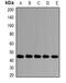 Proteasome 26S Subunit, Non-ATPase 13 antibody, orb381991, Biorbyt, Western Blot image 