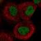 ABL Proto-Oncogene 1, Non-Receptor Tyrosine Kinase antibody, NBP1-90287, Novus Biologicals, Immunofluorescence image 