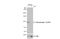 Protein Tyrosine Kinase 2 antibody, GTX129840, GeneTex, Western Blot image 