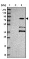 Kelch Repeat And BTB Domain Containing 7 antibody, PA5-60478, Invitrogen Antibodies, Western Blot image 