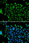 Nuclear Receptor Corepressor 1 antibody, STJ29126, St John