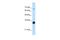 THO Complex 3 antibody, A12990, Boster Biological Technology, Western Blot image 