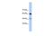 DAZ Associated Protein 1 antibody, GTX47277, GeneTex, Western Blot image 