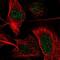 Plakophilin 1 antibody, NBP1-90041, Novus Biologicals, Immunofluorescence image 