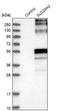 Solute Carrier Family 29 Member 2 antibody, NBP1-85253, Novus Biologicals, Western Blot image 