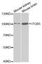 Integrin Subunit Beta 5 antibody, LS-C332121, Lifespan Biosciences, Western Blot image 