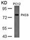 Protein Kinase C Delta antibody, orb14671, Biorbyt, Western Blot image 