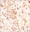 GLI Family Zinc Finger 1 antibody, PA5-72942, Invitrogen Antibodies, Immunohistochemistry paraffin image 