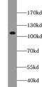 TSC22 Domain Family Member 2 antibody, FNab09036, FineTest, Western Blot image 