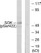 Serum/Glucocorticoid Regulated Kinase 1 antibody, LS-C199563, Lifespan Biosciences, Western Blot image 