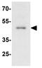 Apolipoprotein B MRNA Editing Enzyme Catalytic Subunit 3B antibody, GTX17214, GeneTex, Western Blot image 