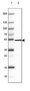 ST13 Hsp70 Interacting Protein antibody, NBP2-61615, Novus Biologicals, Western Blot image 