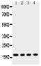 Myoglobin antibody, PA5-79638, Invitrogen Antibodies, Western Blot image 