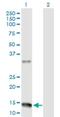 Neuromedin U antibody, H00010874-D01P, Novus Biologicals, Western Blot image 