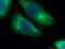Keratin 6B antibody, 17391-1-AP, Proteintech Group, Immunofluorescence image 