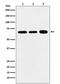 Ribosomal Protein S6 Kinase B1 antibody, M01475-4, Boster Biological Technology, Western Blot image 