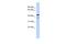 NOP2/Sun RNA Methyltransferase 4 antibody, A09446, Boster Biological Technology, Western Blot image 