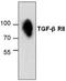 Transforming Growth Factor Beta Receptor 2 antibody, TA319109, Origene, Western Blot image 