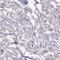 UL16 Binding Protein 3 antibody, NBP2-31866, Novus Biologicals, Immunohistochemistry frozen image 