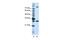 Serine And Arginine Rich Splicing Factor 10 antibody, PA5-41929, Invitrogen Antibodies, Western Blot image 