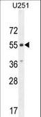 Atypical Chemokine Receptor 3 antibody, LS-C168868, Lifespan Biosciences, Western Blot image 